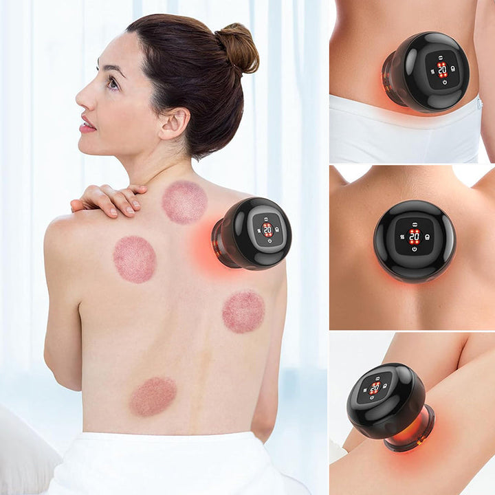 BowLift | Vacuum Cupping & Scraping Instrument