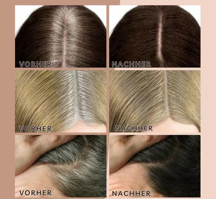 BowLift | HairHalo – Perfect hairlines anytime