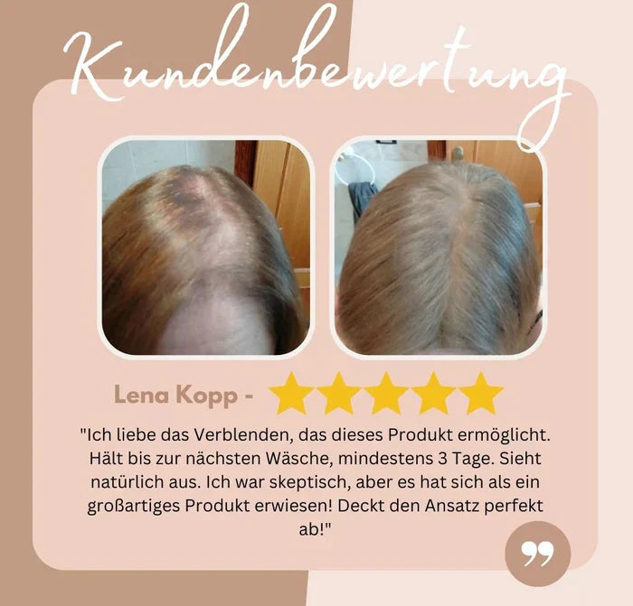 BowLift | HairHalo – Perfect hairlines anytime