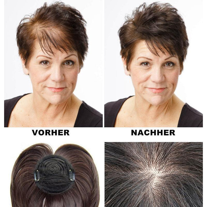 Special head hairpiece