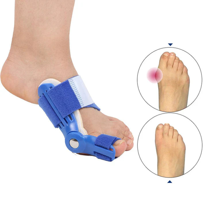 BowLift | Hallux Valgus correction splint (1 pair)