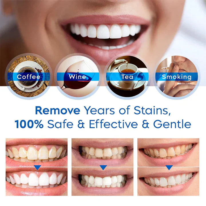 BowLift | Tooth Whitening Pens