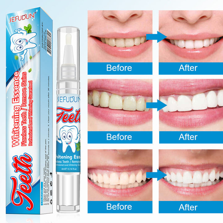 BowLift | Tooth Whitening Gel Pen