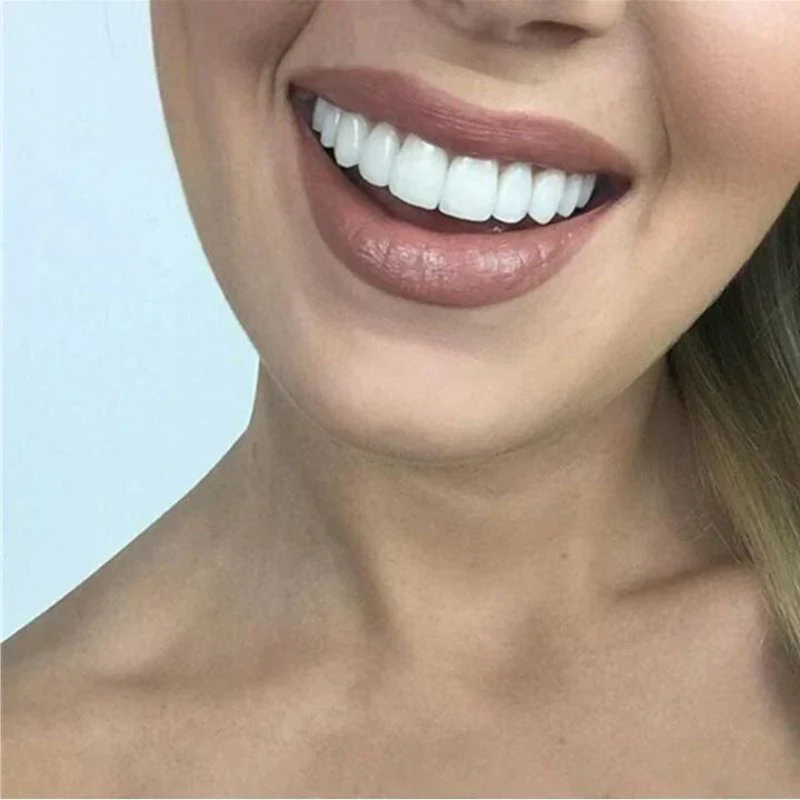 BowLift | SnapFit Dental Restoration | Always a Flawless Smile