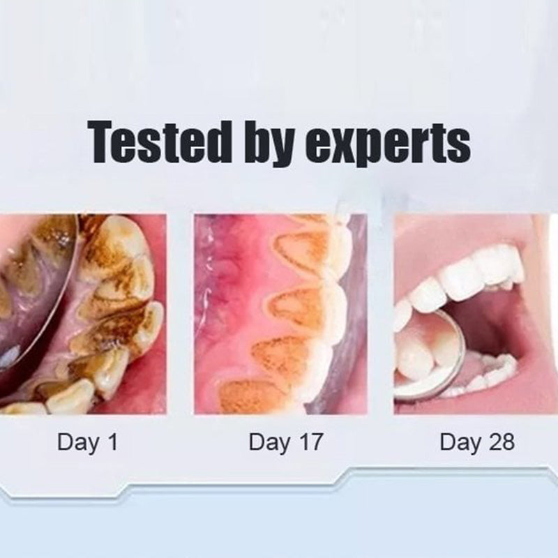 BowLift | Super Probiotic-6 Toothpaste