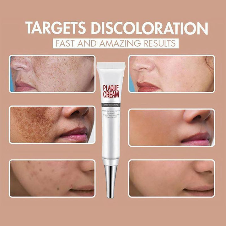 BowLift | Face Freckles Removal Cream