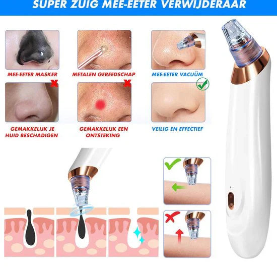 BowLift | Electric Blackhead Remover