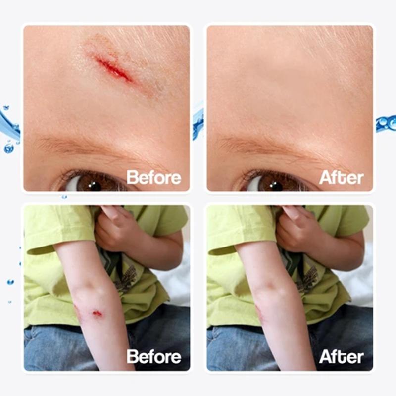 BowLift | Waterproof Liquid Bandage