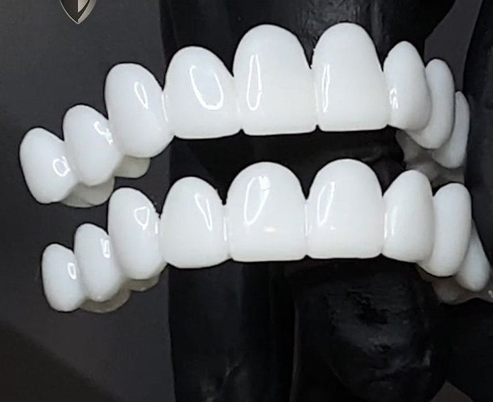 BowLift | Cosmetic Tooth Toppers SmileShape – Reusable, Flexible and Naturally White