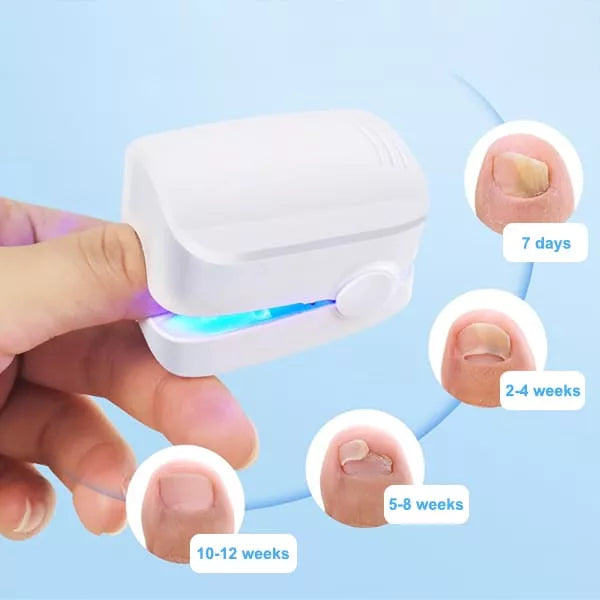 BowLift | Nail Fungus Cleaning Laser Device