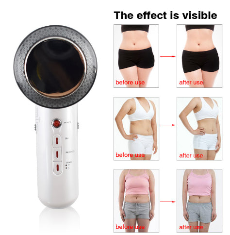 BowLift | Ultrasound Massage Device