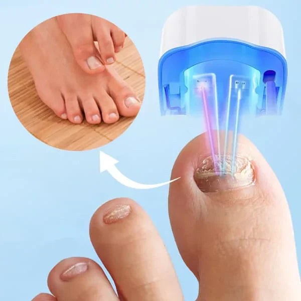 BowLift | Nail Fungus Cleaning Laser Device