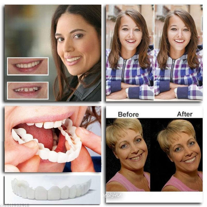 BowLift | Snap-On Dentures