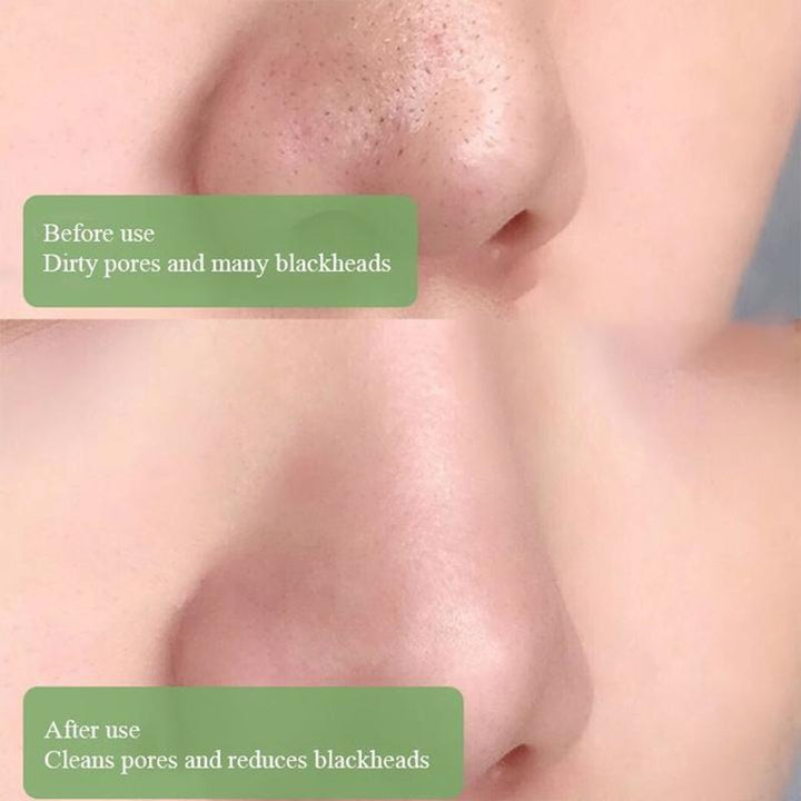 BowLift | SOLID CLEANSING MASK