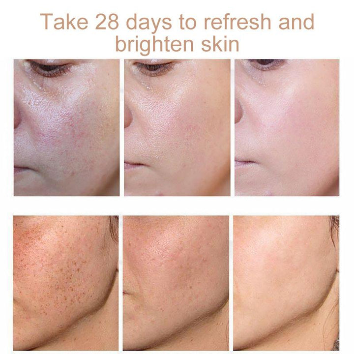 BowLift | Face Freckles Removal Cream
