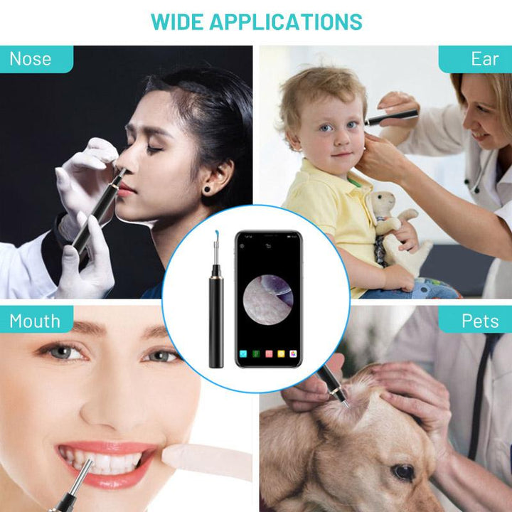 BowLift | Wireless Earwax Remover Tool