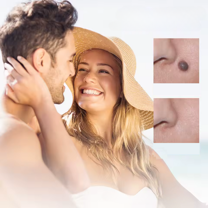 BowLift | WartAway – Remove warts, completely without chemicals!