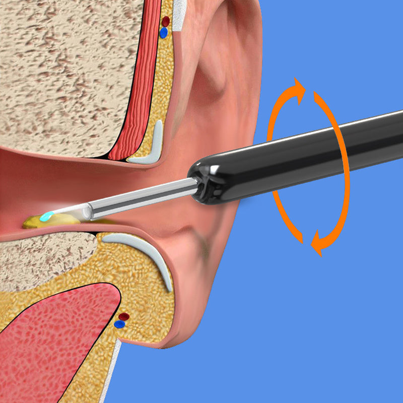 BowLift | Smart Visible Earpick