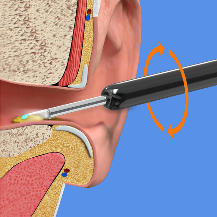 BowLift | Smart Visible Earpick