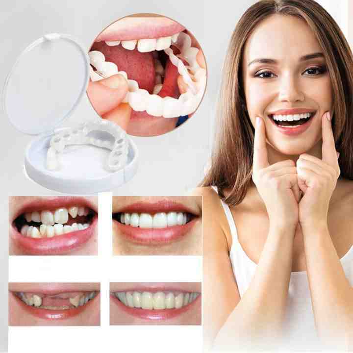 BowLift | Snap-On Dentures