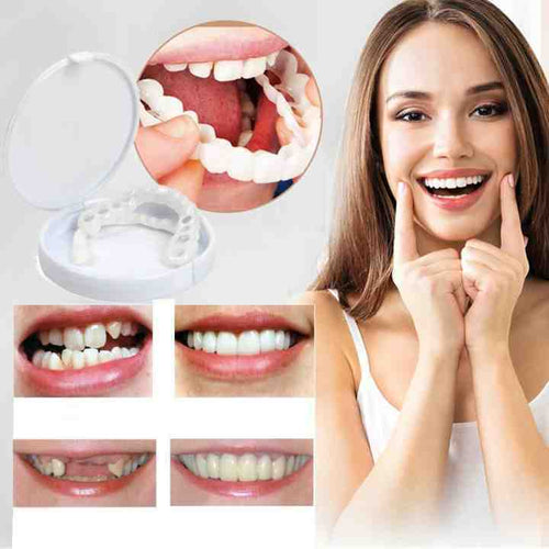 BowLift | Snap-On Dentures