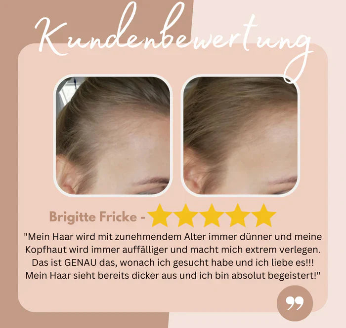 BowLift | HairHalo – Perfect hairlines anytime