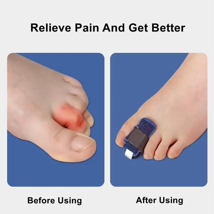 BowLift | Gentle Touch Toe Corrector Stabilizer