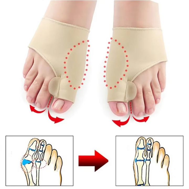 BowLift | Orthopedic Toe Separator and Bunion Corrector for Pain Relief and Foot Alignment