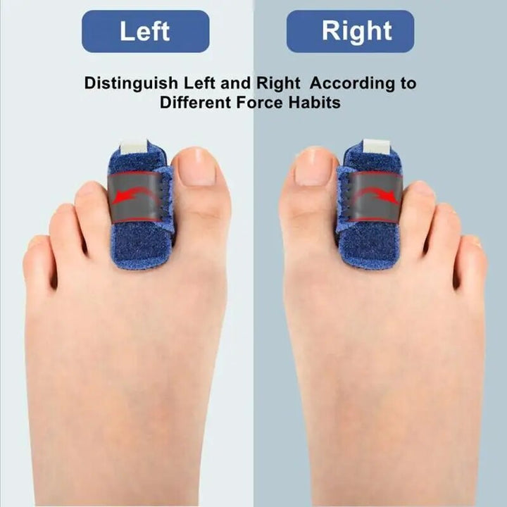 BowLift | Gentle Touch Toe Corrector Stabilizer