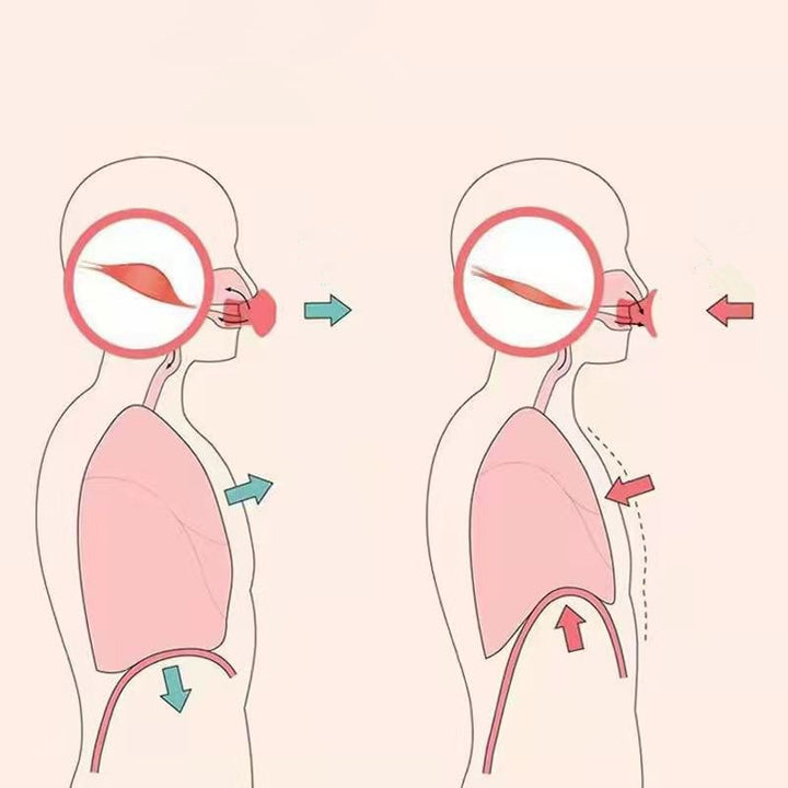 BowLift | Facial Tightening