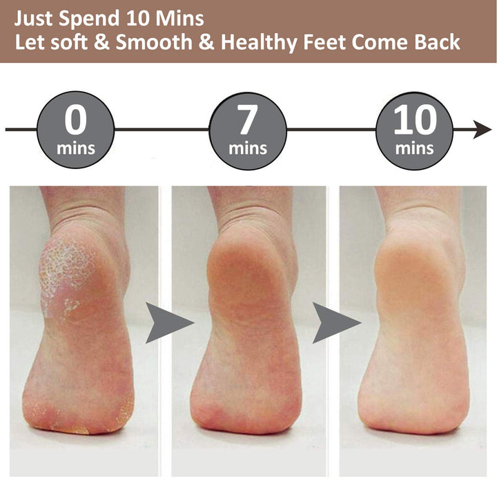 BowLift | Electric Foot Pedicure Machine