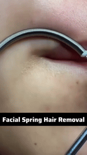 BowLift | Facial Spring Hair Removal
