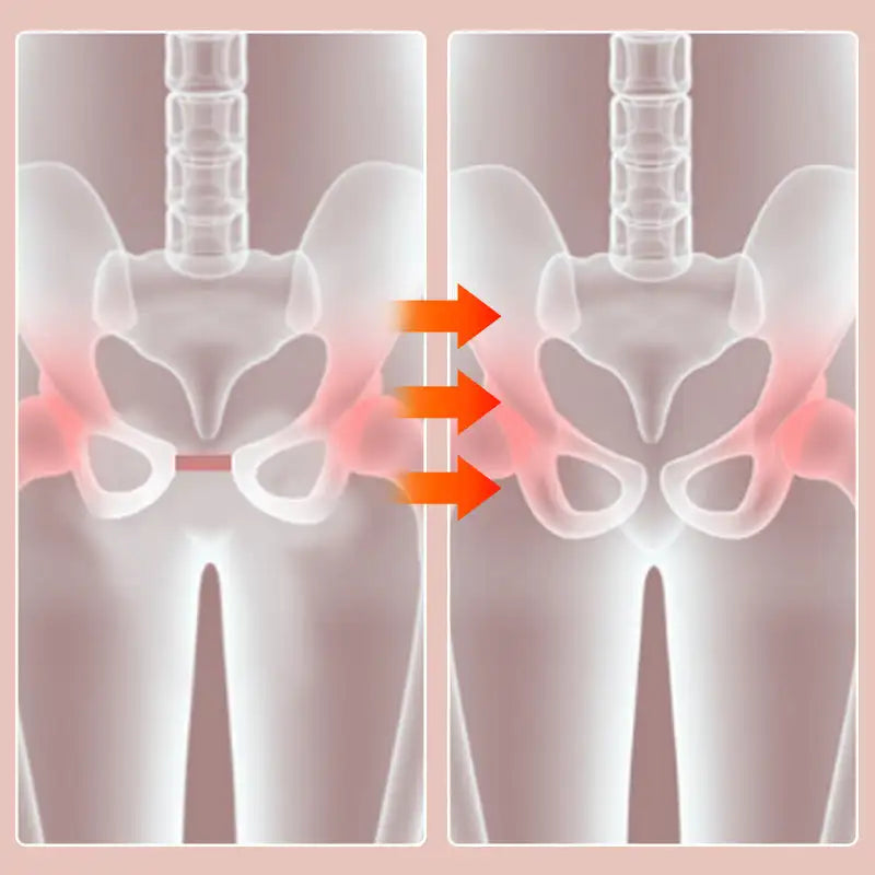 BowLift | Smart Pelvic Trainer