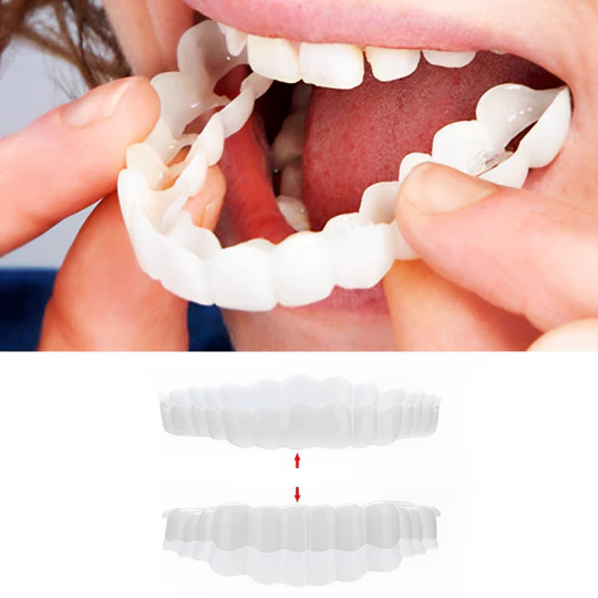 BowLift | Smile Veneer (Upper & Lower Included)