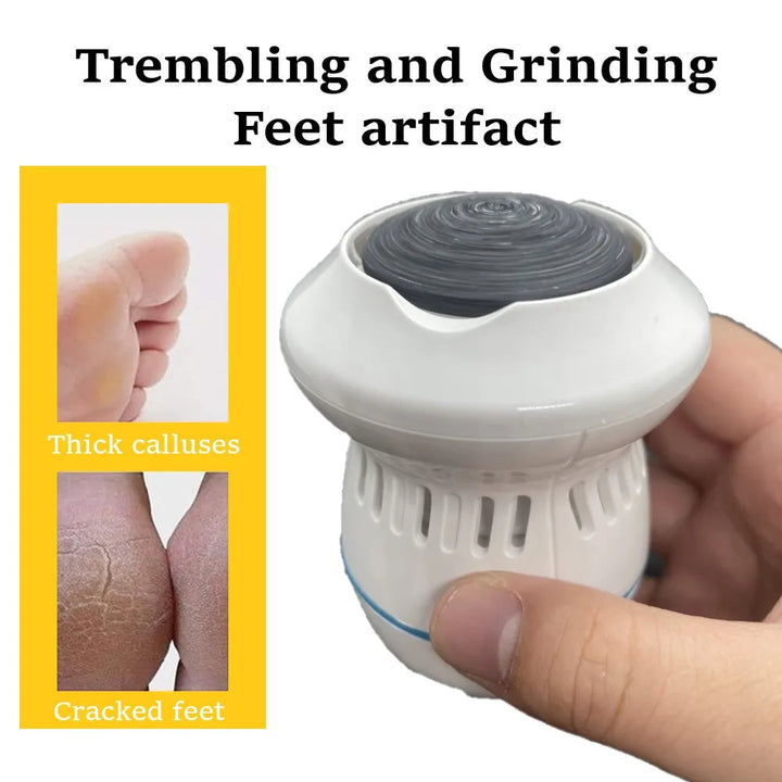 BowLift | Vacuum Callus Remover